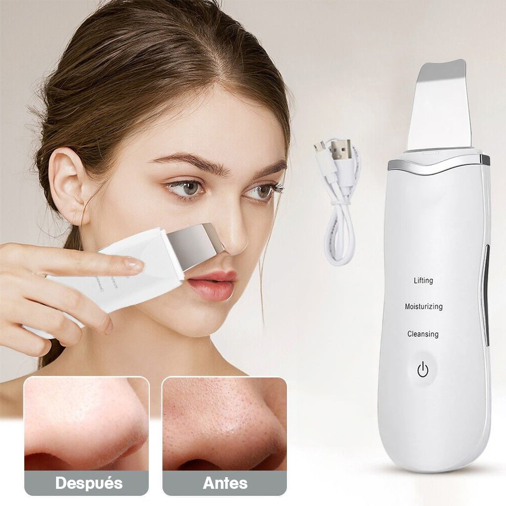 Limpiador Facial Ultrasónico (Elimina impurezas)